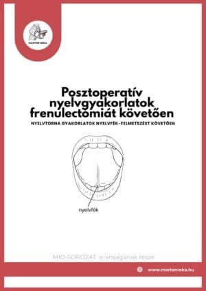 Posztoperatív nyelvgyakorlatok frenulectómiát követően
